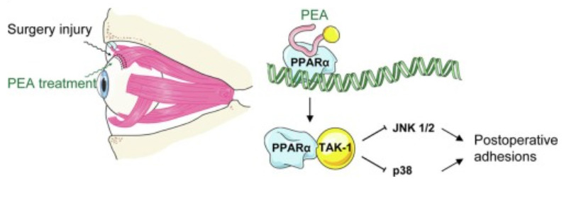ns166843481-palmitoylethanolamide_pea_cas_544_31_0_could_be_a_novel_therapeutic_approach_for_postoperative_adhesions_after_strabismus_surgery_in_rabbit.jpg